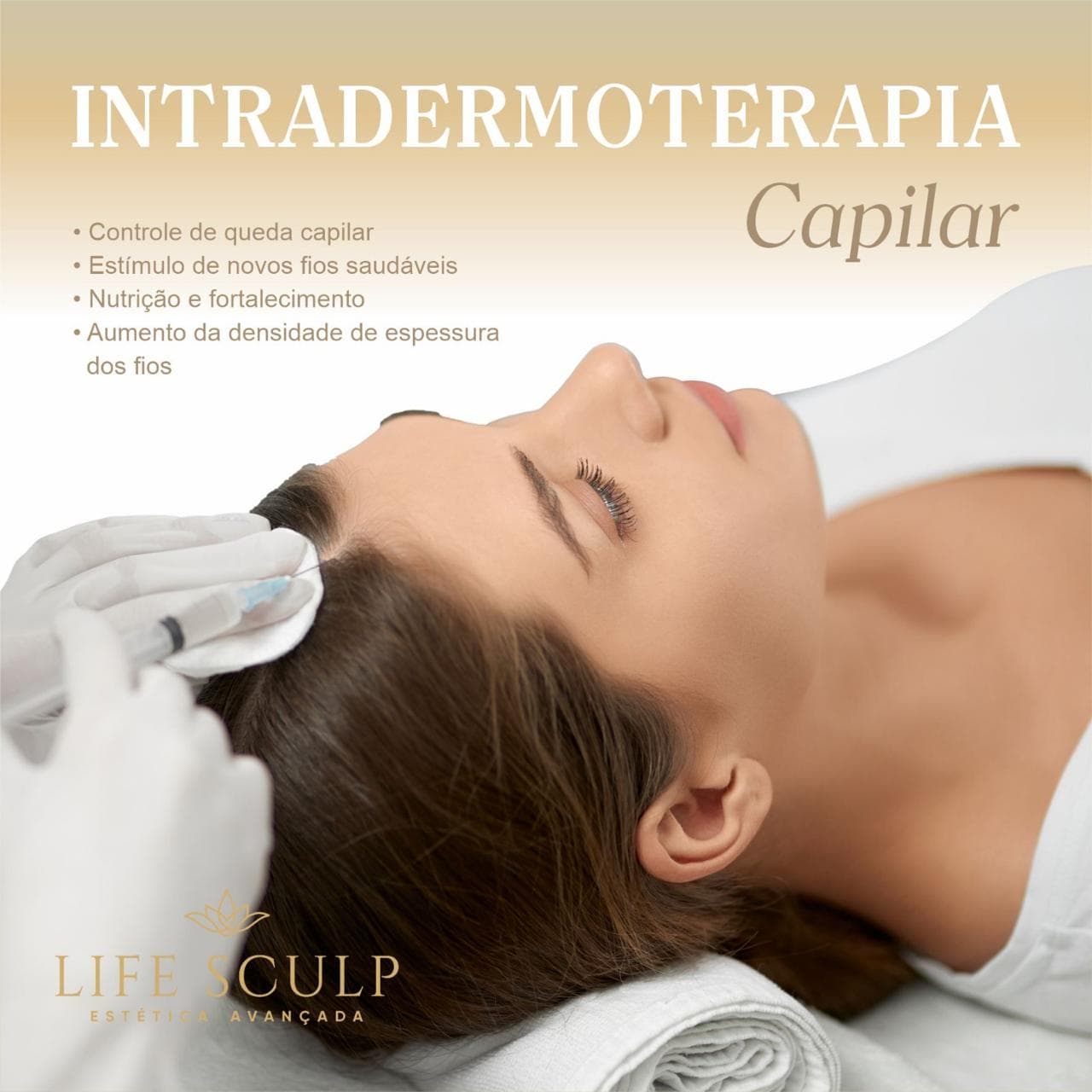 Intradermoterapia Capilar