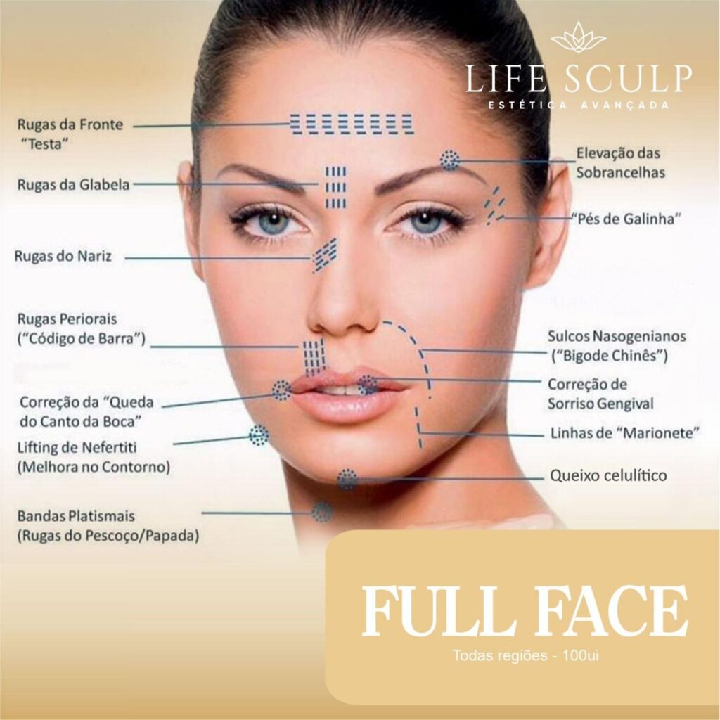 botox full face